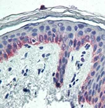 Cytokeratin 5 Antibody