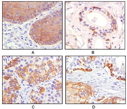 Cytokeratin 5 Antibody