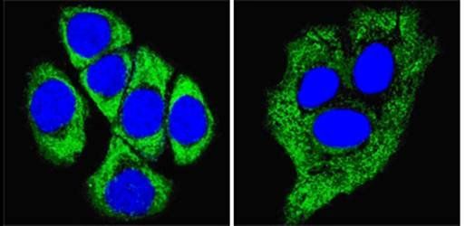 Cytokeratin 8 Antibody