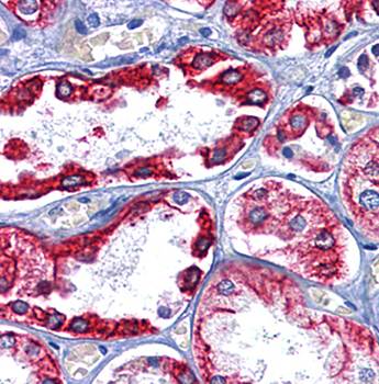 Cytokeratin 8 Antibody