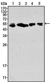 Cytokeratin 8 Antibody