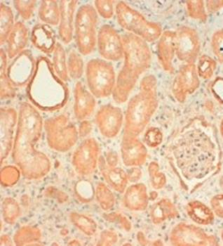 Cytokeratin (pan) basic type 2 Monoclonal Antibody