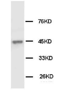 Anti-Cytokeratin Peptide 18 KRT18 Antibody (Monoclonal, CY-90)