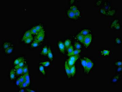 Cytoplasmic protein NCK2 antibody