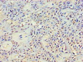 NCK2 Antibody