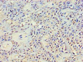 Cytoplasmic protein NCK2 antibody