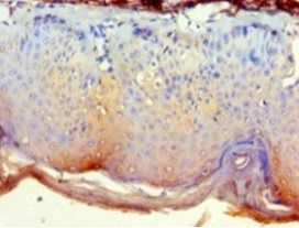 NCK2 Antibody