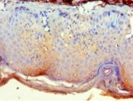 Cytoplasmic protein NCK2 antibody