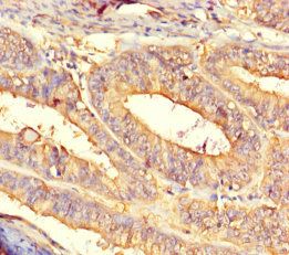 CNDP2 Antibody