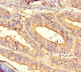 Cytosolic non-specific dipeptidase antibody