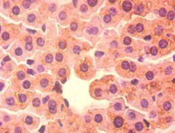 BDH1 Antibody