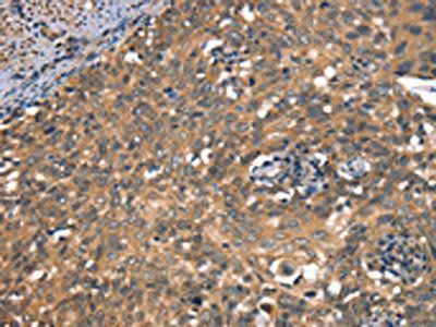 DAAM1 Antibody