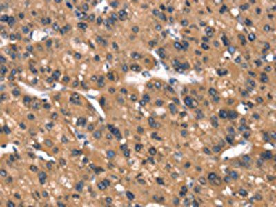 DAAM1 Antibody