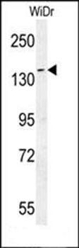 DAAM1-T361 antibody