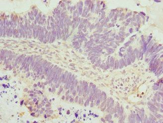 DAAM2 Antibody