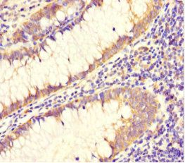 DAAM2 Antibody