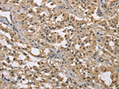 DACH2 antibody