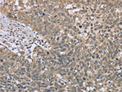 DACH2 Antibody
