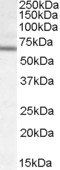 Dachshund homolog 2/DACH2 Antibody