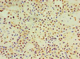 DACT3 Antibody