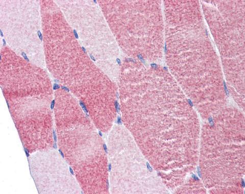 DAP5 antibody