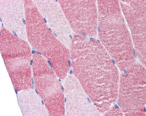 eukaryotic translation initiation factor 4 gamma 2 Antibody