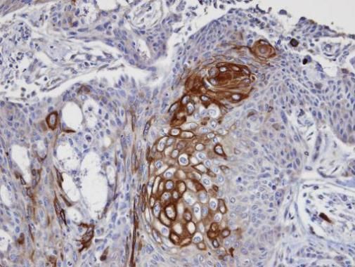 eukaryotic translation initiation factor 4 gamma 2 Antibody