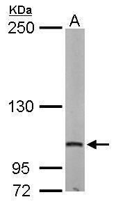 eukaryotic translation initiation factor 4 gamma 2 Antibody