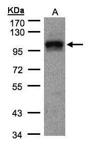 eukaryotic translation initiation factor 4 gamma 2 Antibody