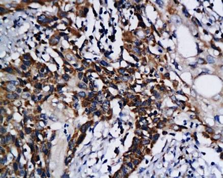 DAPK1 Rabbit Polyclonal Antibody