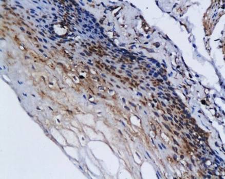 DAPK1 Rabbit Polyclonal Antibody