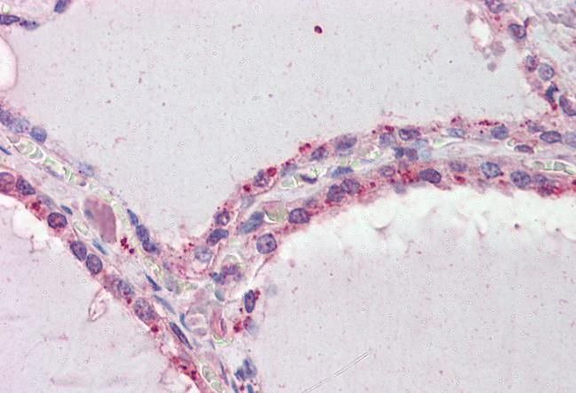 Goat anti-DAPK2 Antibody