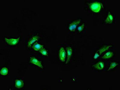 DAPK2 Antibody