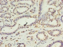 DAPK2 Antibody