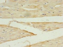 DAPK2 Antibody