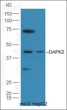 DAPK2 antibody