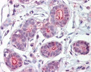 Goat anti-DAPK2 Antibody