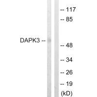 DAPK3 (Ab-265) Antibody