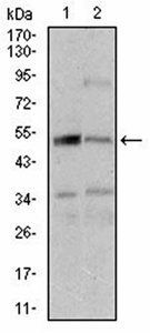 DAPK3 Antibody