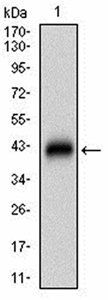 DAPK3 Antibody