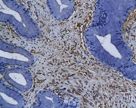 ZIP Kinase Rabbit Polyclonal Antibody