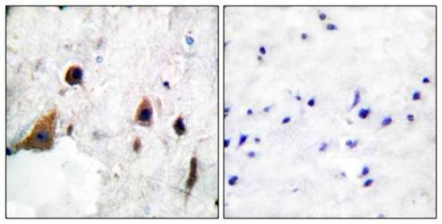 DARPP-32 (Phospho-Thr75) Antibody