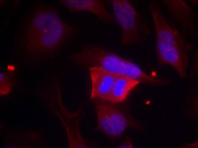 DARPP-32 (Phospho-Thr75) Antibody