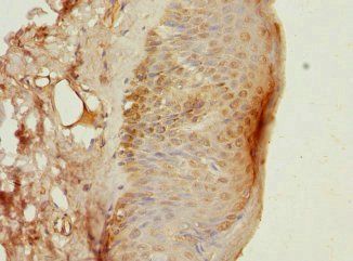 DAZ2 Antibody