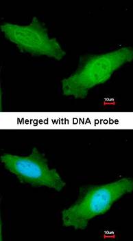 DAZ2 antibody