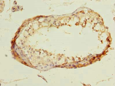 DBF4B Antibody