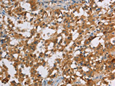 DBH Antibody