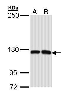PPFIBP2 antibody
