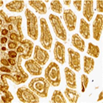DC-SIGN Antibody