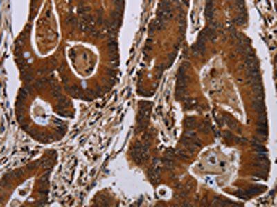 DCAF6 Antibody